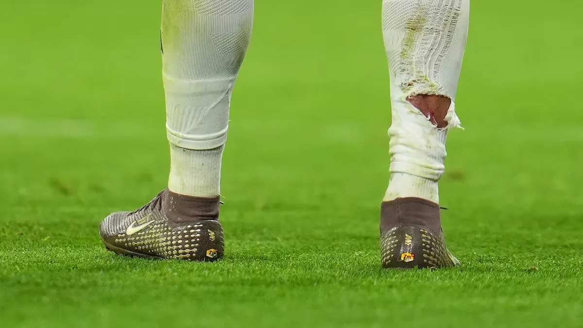 世界杯官方app下载入口-球袜被直接踢破！姆巴佩遭拜仁后卫塔犯规后，血痕清晰可见